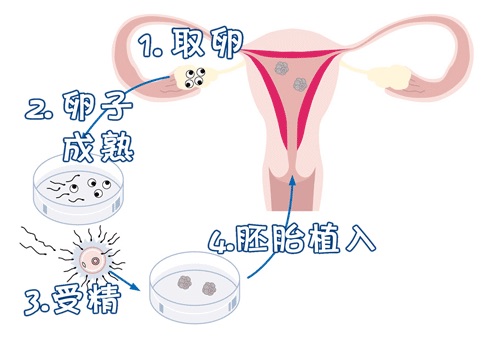 遗传阻断案例